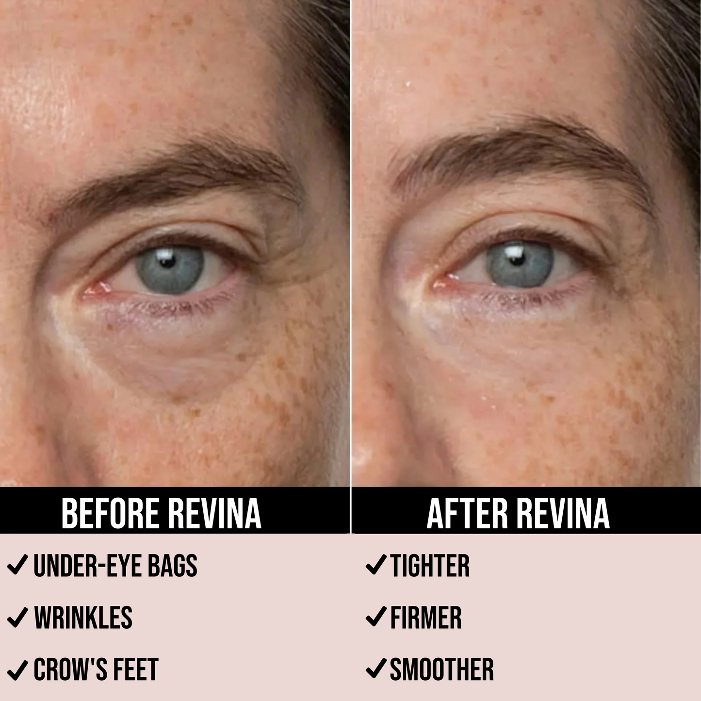 REVINA Eye Bag Instant Eraser