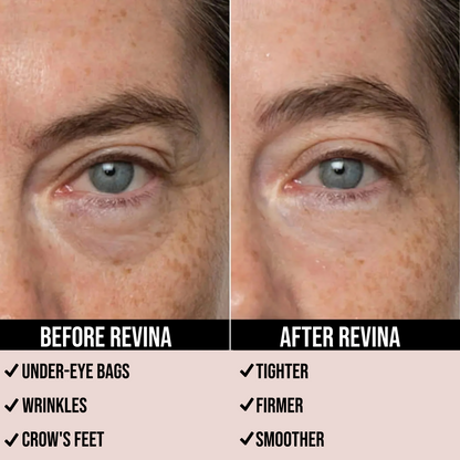 REVINA Eye Bag Instant Eraser